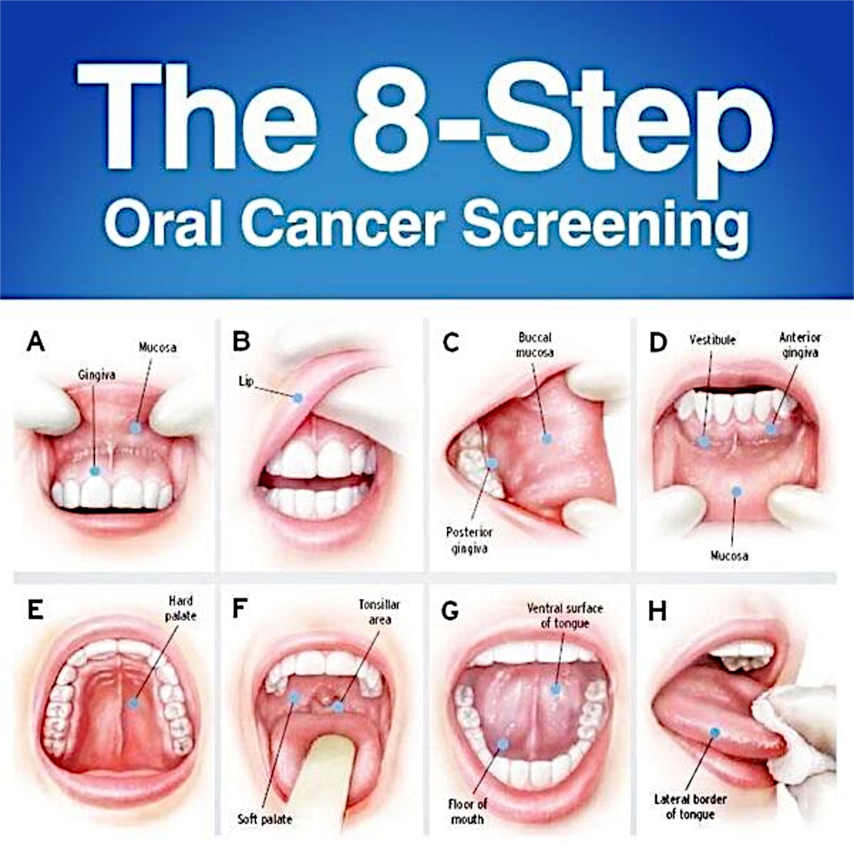 Everyone Should Acknowledge The Importance Of The Regular Oral Cancer 